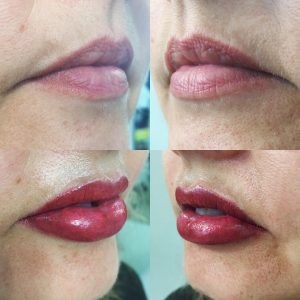 Lash Enhancement Kelowna